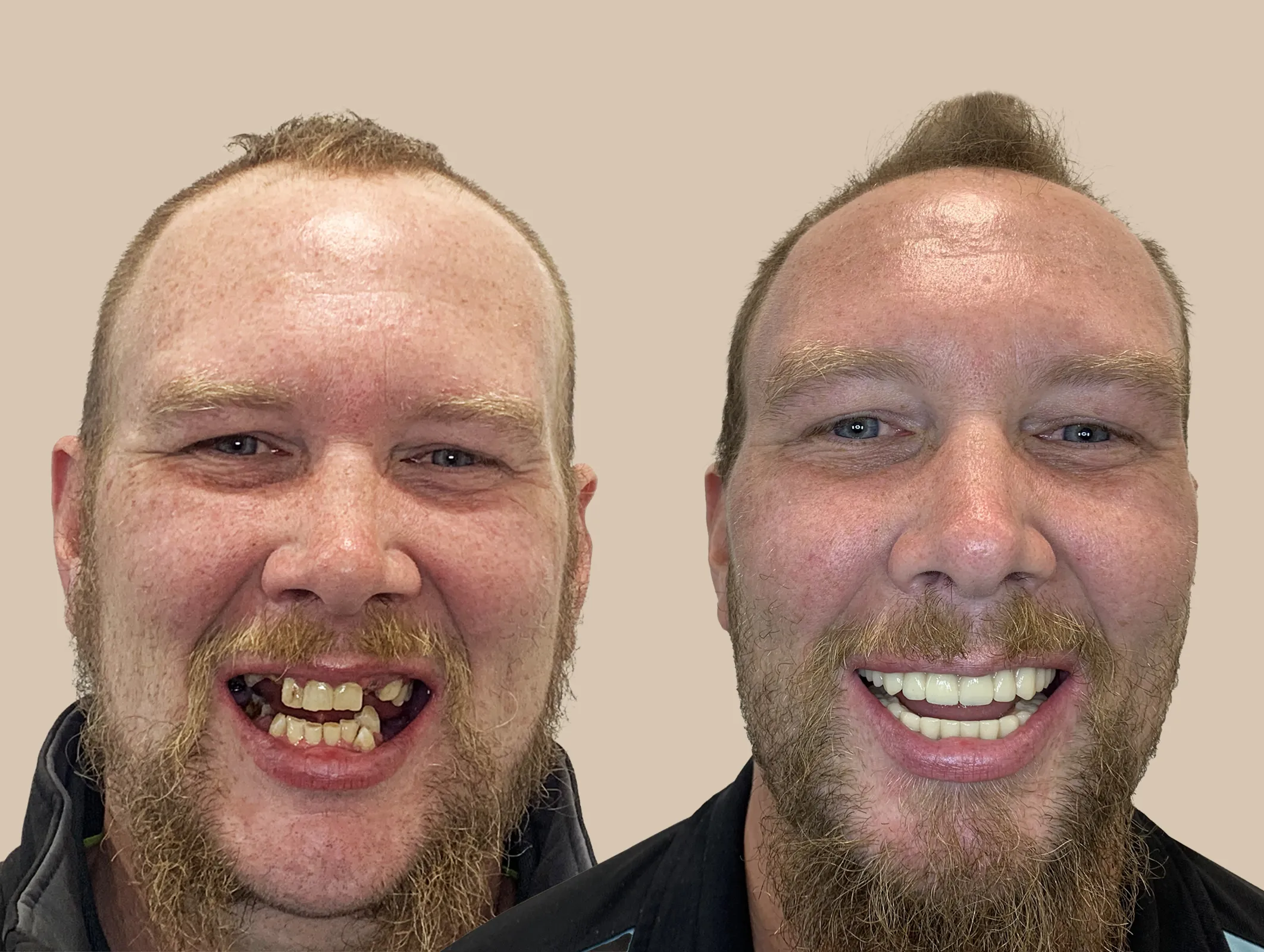 DamonMaguire Before After copy