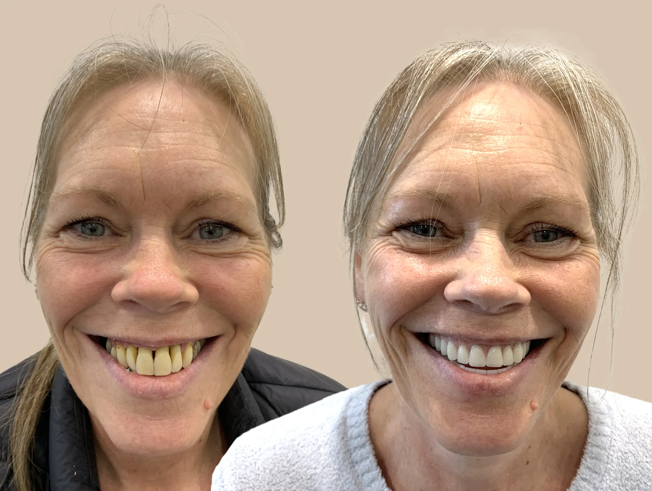 Jane Ewert Retouched copy