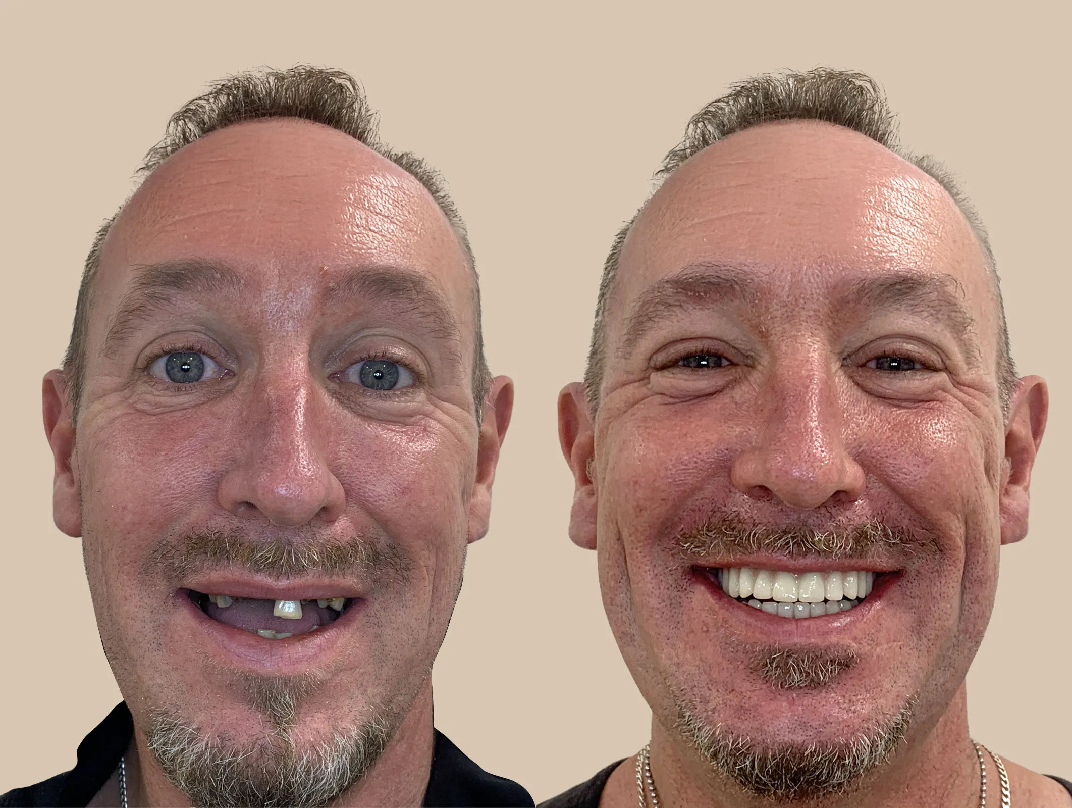 Stephan Lewis Retouched copy