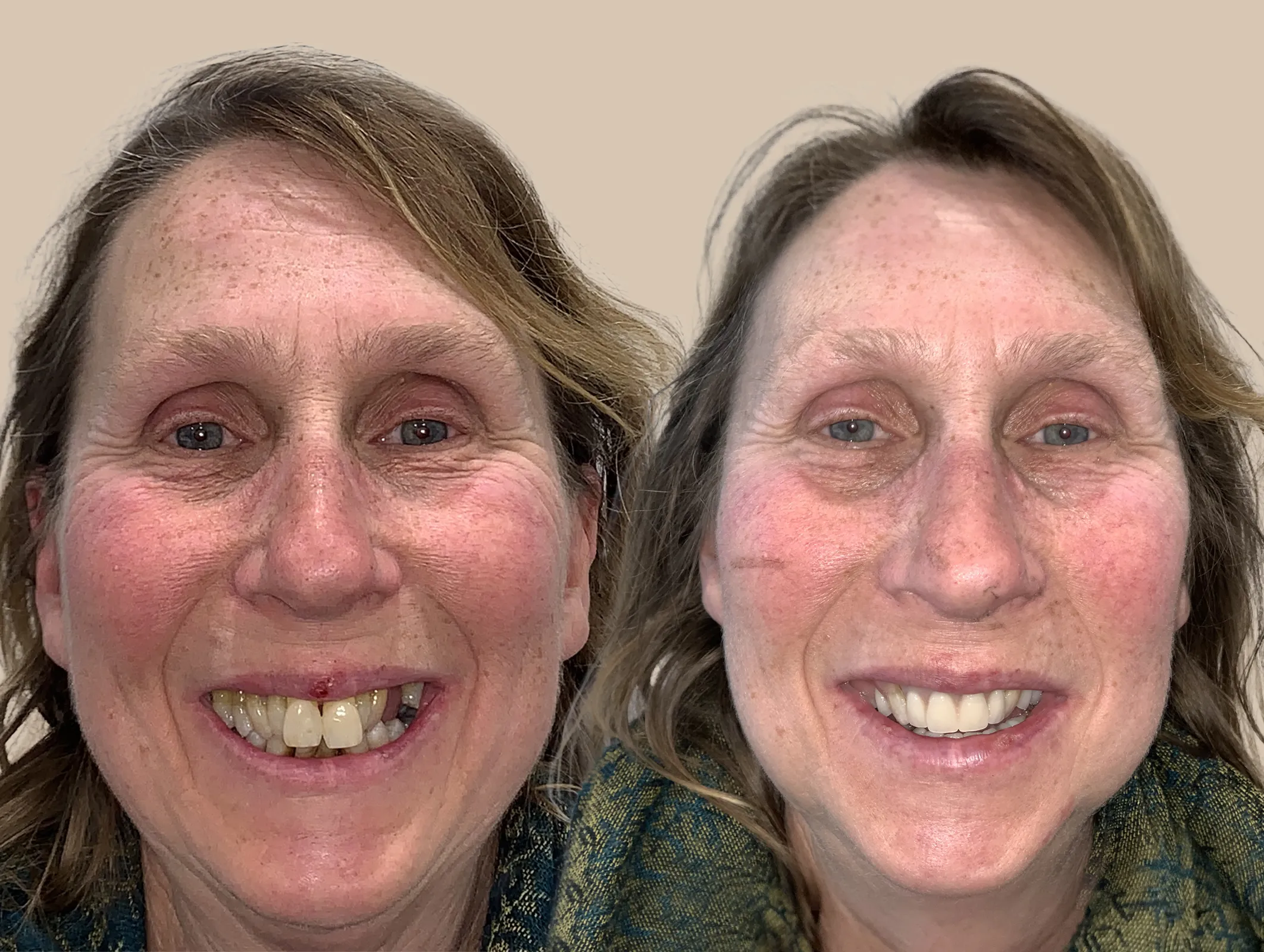 Wendy Neagle Retouched copy